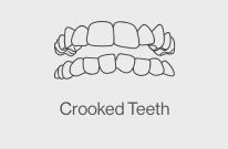 crooked teeth