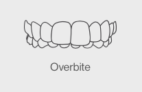 overbite